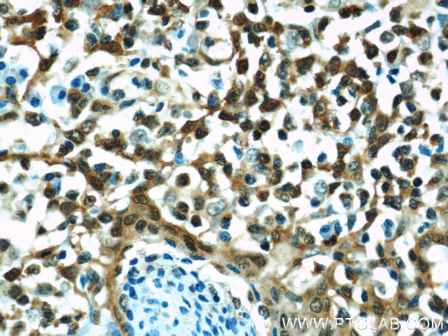 Cyclophilin A Antibody in Immunohistochemistry (Paraffin) (IHC (P))