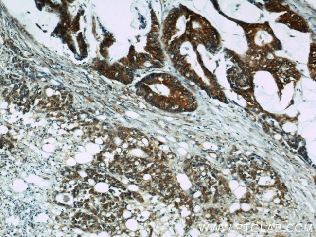 Cyclophilin A Antibody in Immunohistochemistry (Paraffin) (IHC (P))