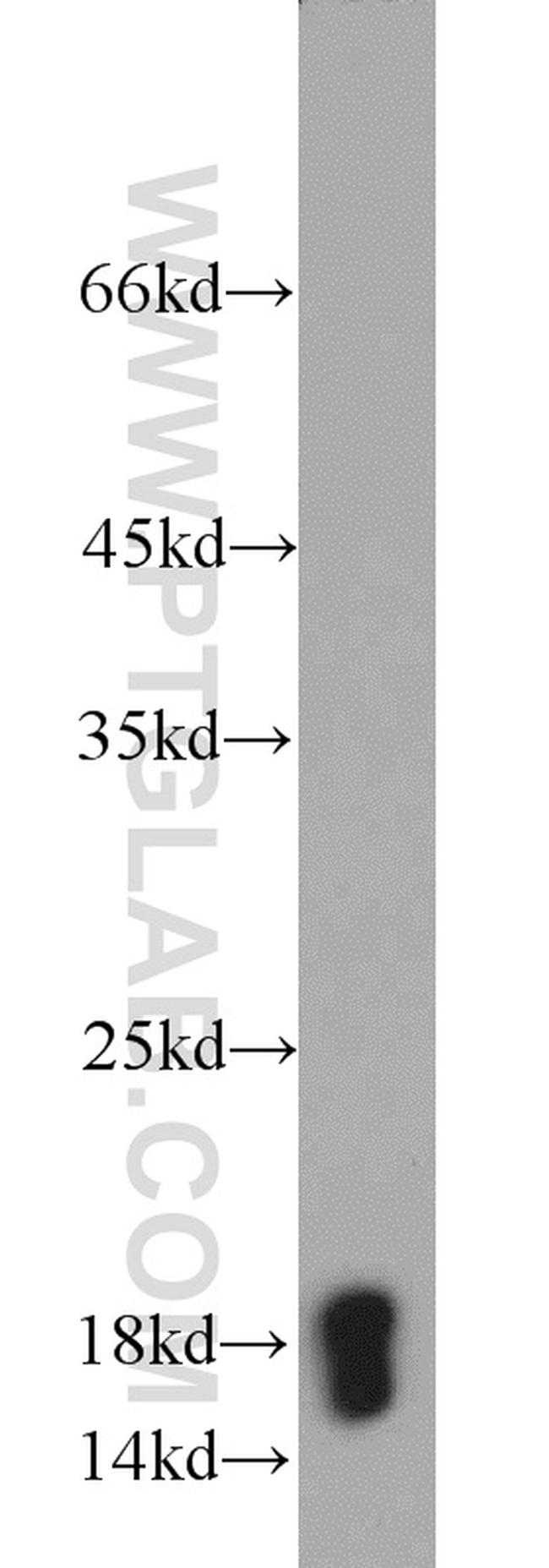 Cyclophilin A Antibody in Western Blot (WB)