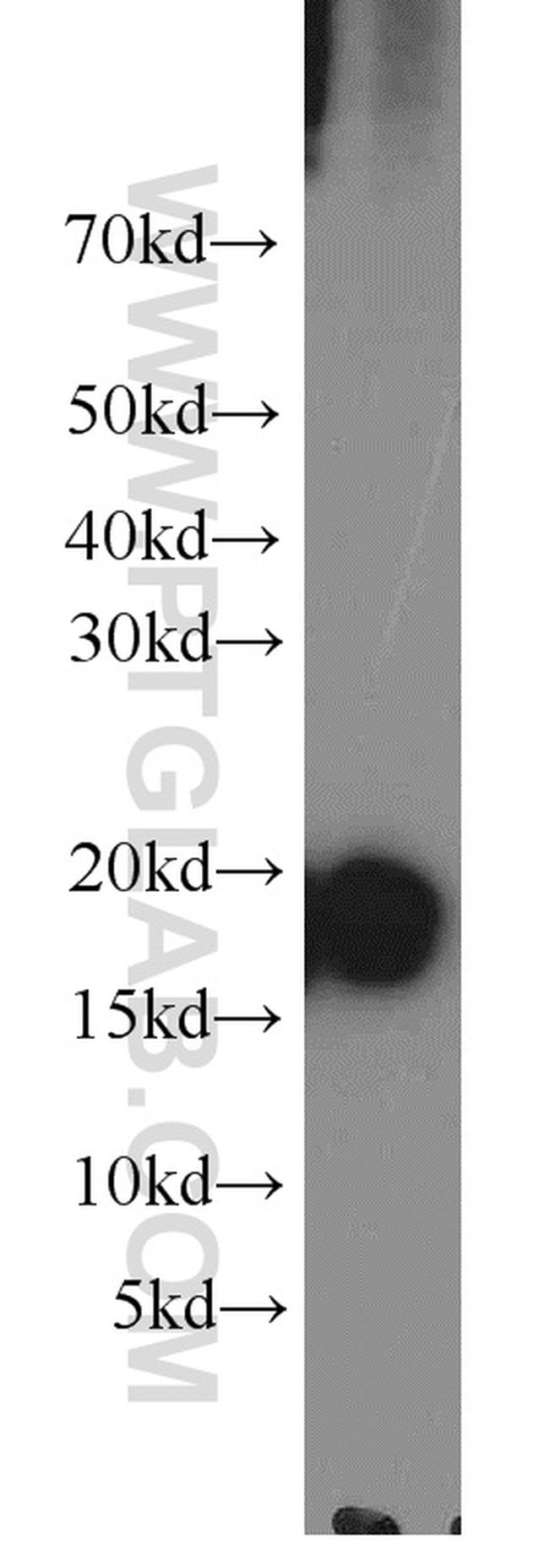 Cyclophilin A Antibody in Western Blot (WB)