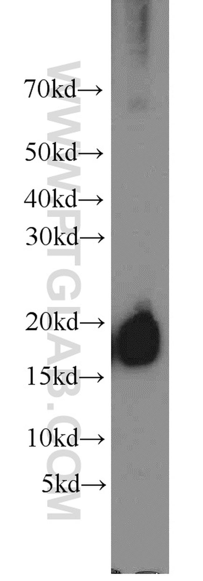 Cyclophilin A Antibody in Western Blot (WB)