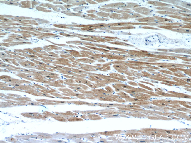 CSRP3 Antibody in Immunohistochemistry (Paraffin) (IHC (P))