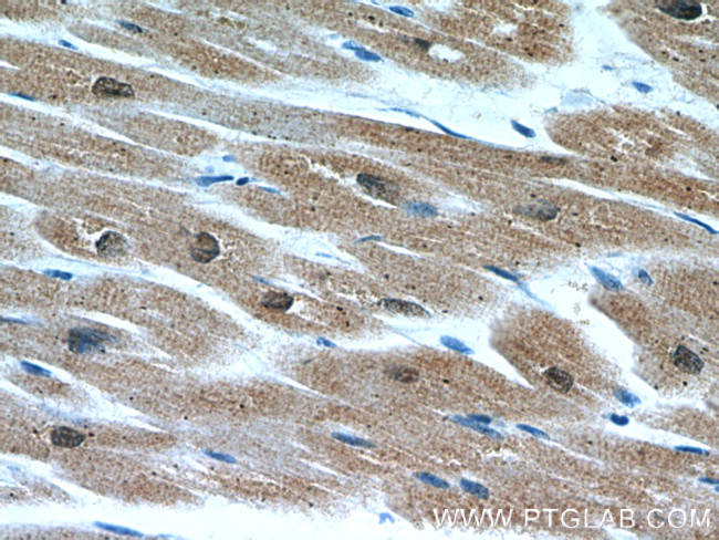 CSRP3 Antibody in Immunohistochemistry (Paraffin) (IHC (P))