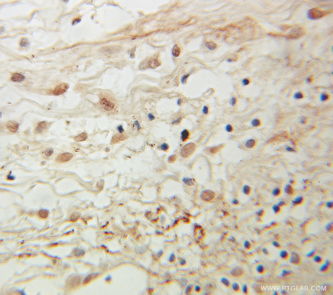 CSRP3 Antibody in Immunohistochemistry (Paraffin) (IHC (P))