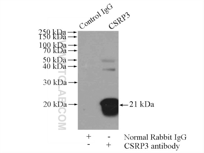 CSRP3 Antibody in Immunoprecipitation (IP)