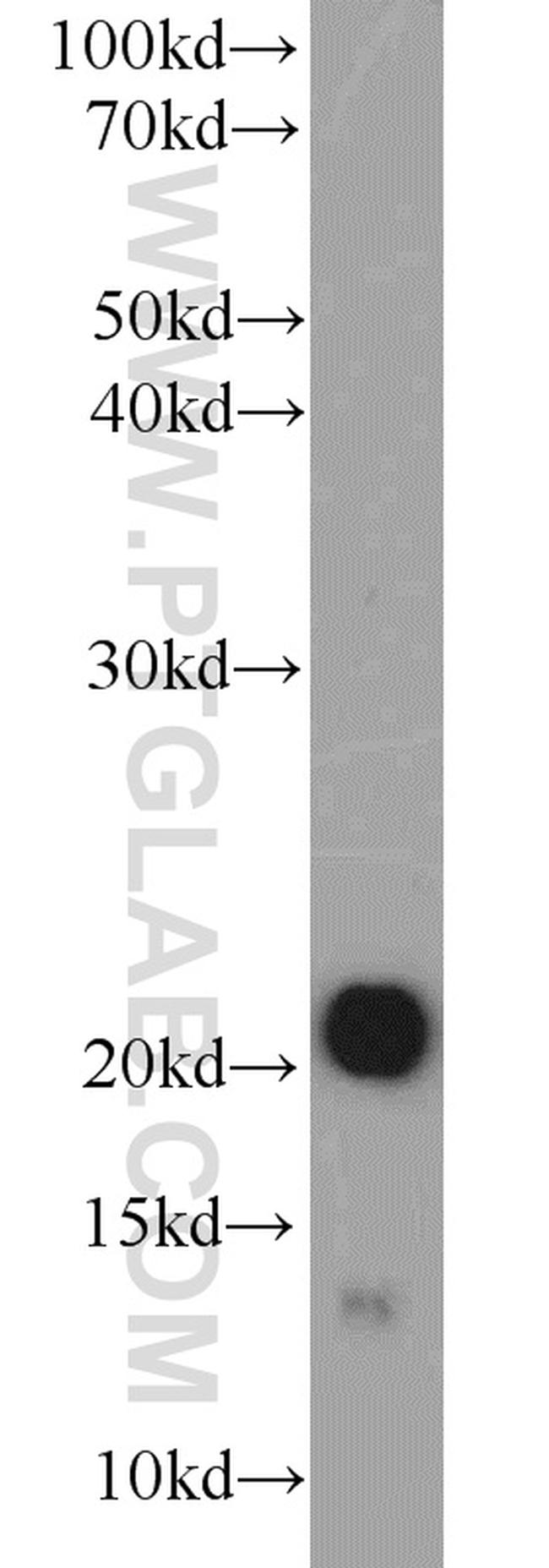 CSRP3 Antibody in Western Blot (WB)