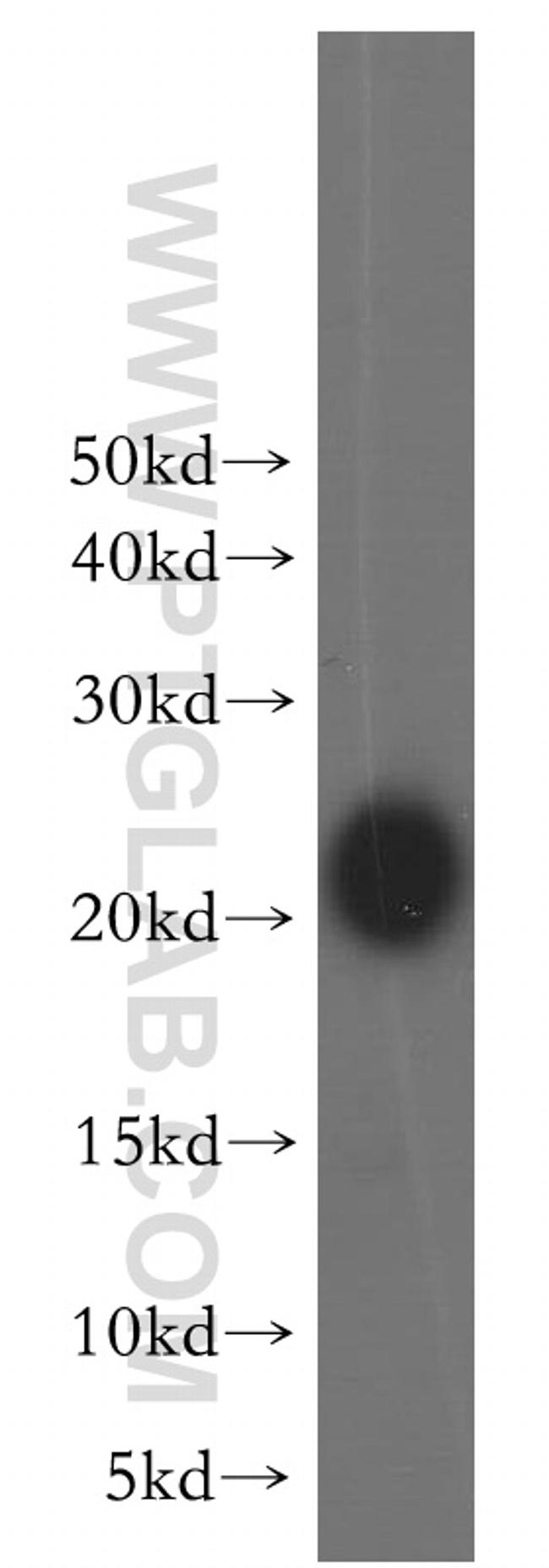 CSRP3 Antibody in Western Blot (WB)