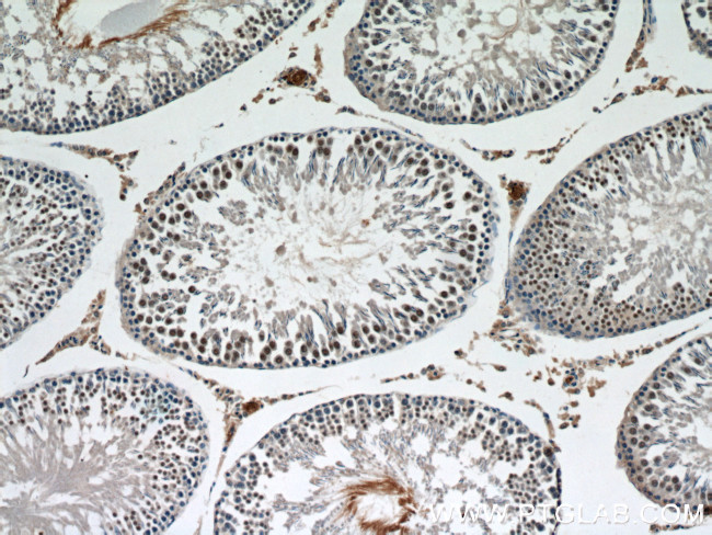 KU70 Antibody in Immunohistochemistry (Paraffin) (IHC (P))