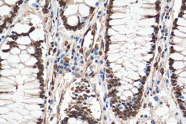 KU70 Antibody in Immunohistochemistry (Paraffin) (IHC (P))