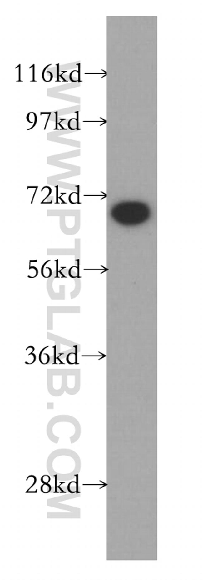 KU70 Antibody in Western Blot (WB)