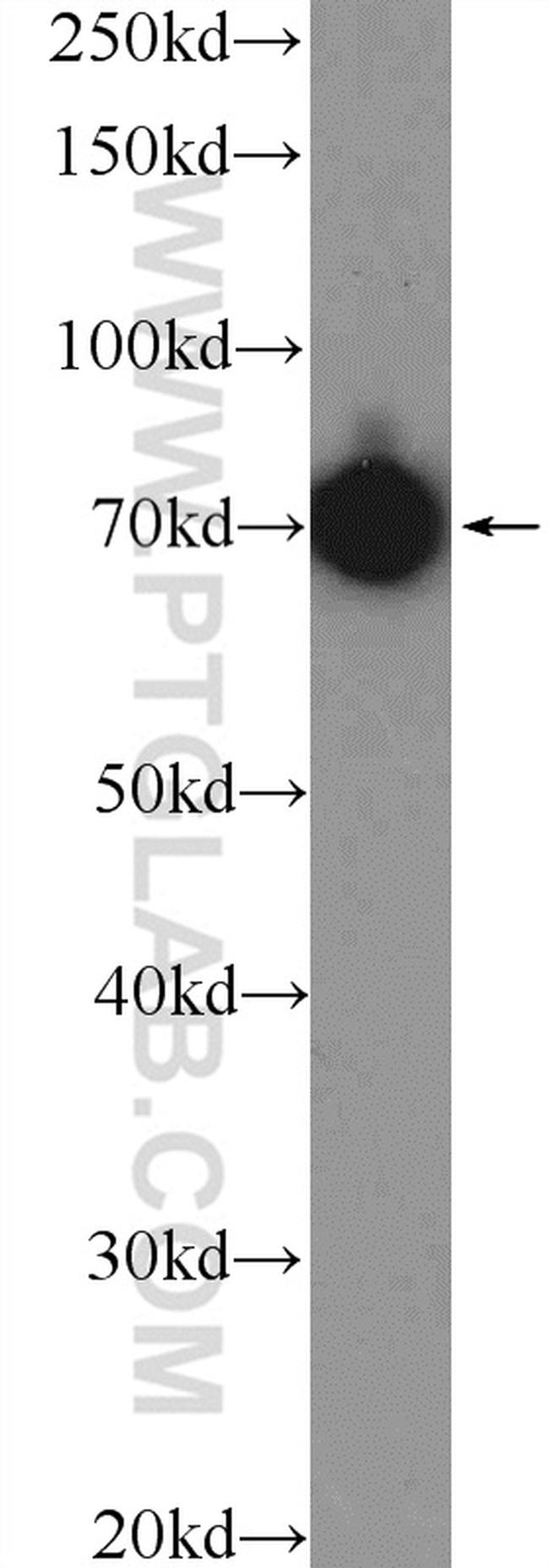 KU70 Antibody in Western Blot (WB)