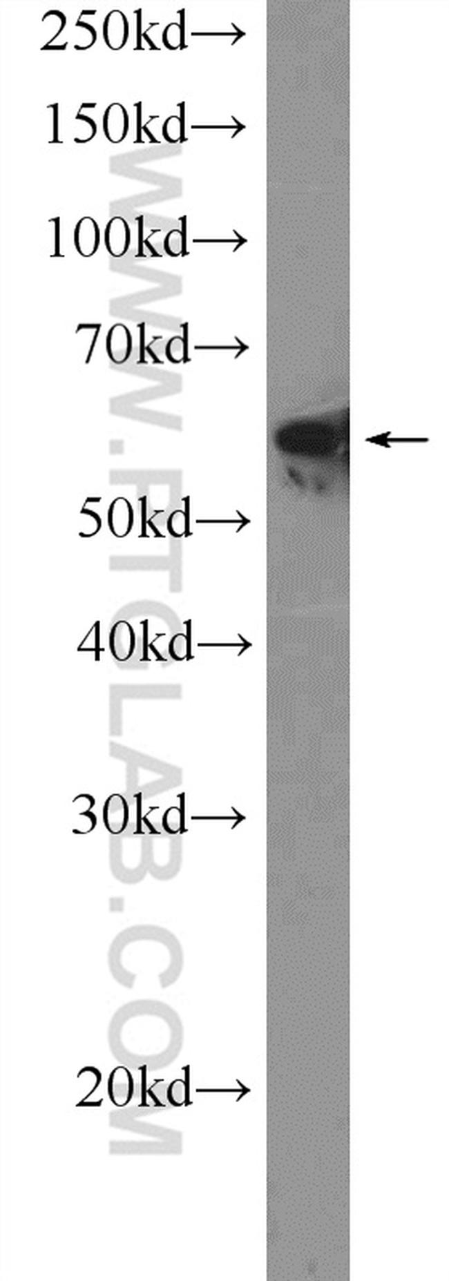 KU70 Antibody in Western Blot (WB)