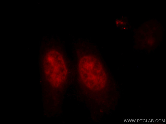 KU70 Antibody in Immunocytochemistry (ICC/IF)