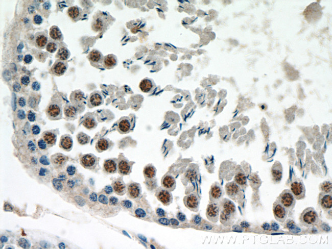 KU70 Antibody in Immunohistochemistry (Paraffin) (IHC (P))