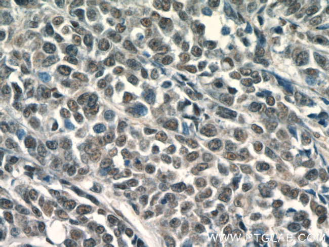 KU70 Antibody in Immunohistochemistry (Paraffin) (IHC (P))