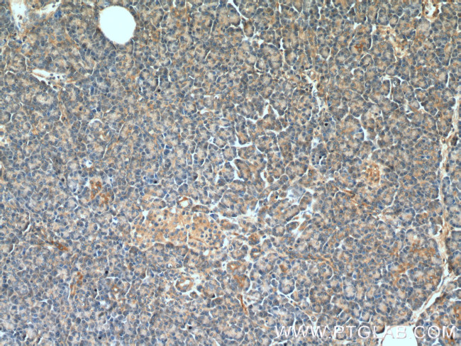 NRAS Antibody in Immunohistochemistry (Paraffin) (IHC (P))