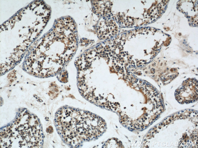 NRAS Antibody in Immunohistochemistry (Paraffin) (IHC (P))