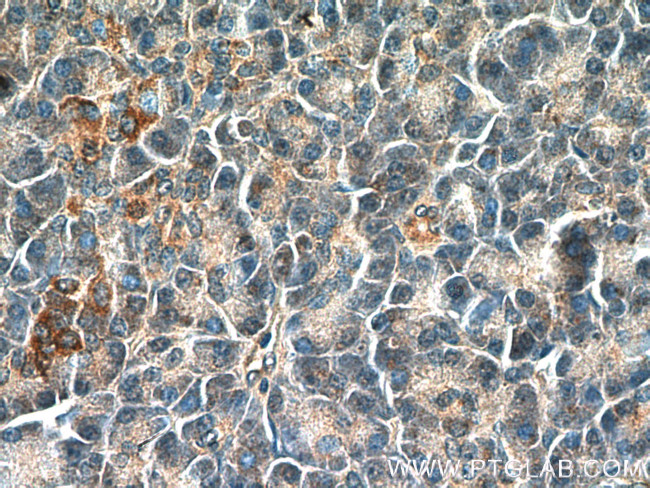 NRAS Antibody in Immunohistochemistry (Paraffin) (IHC (P))