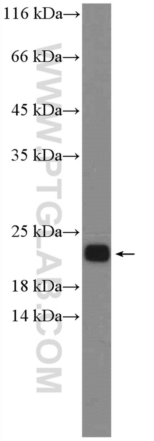 NRAS Antibody in Western Blot (WB)