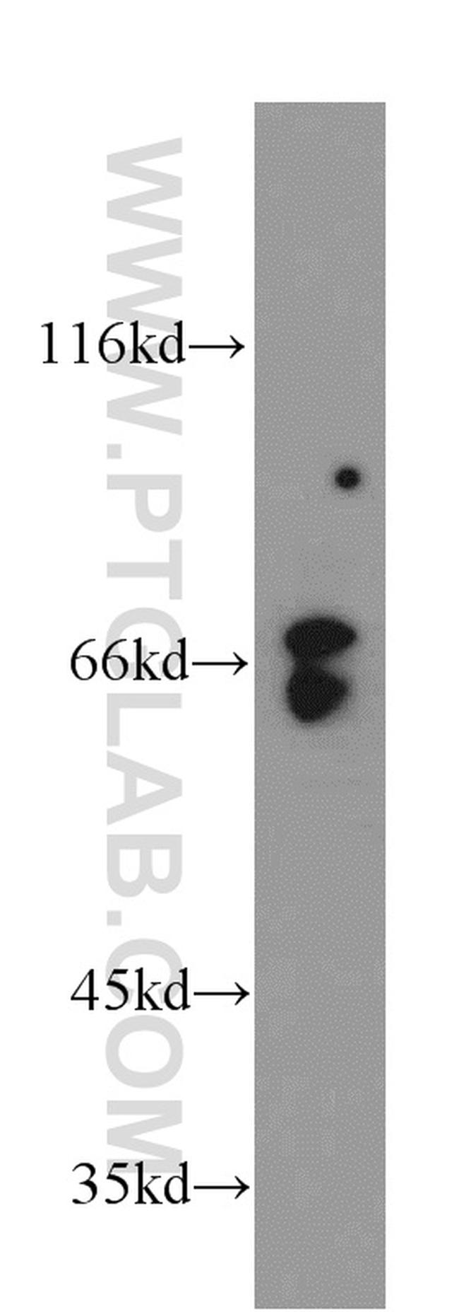 ATIC Antibody in Western Blot (WB)