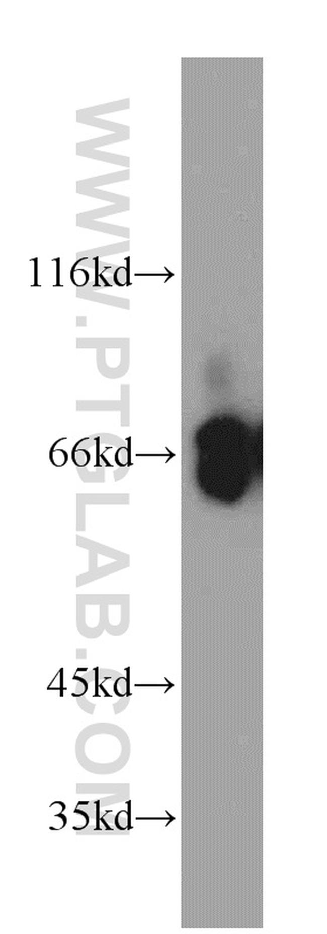 ATIC Antibody in Western Blot (WB)