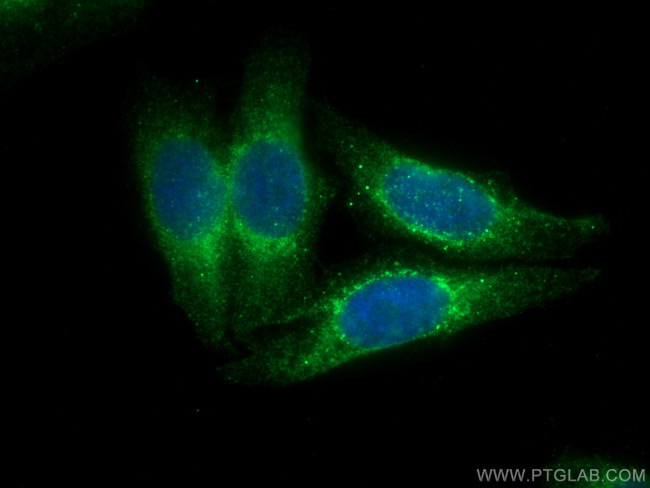 Ferritin light chain Antibody in Immunocytochemistry (ICC/IF)