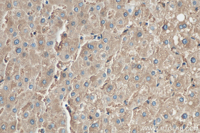 Ferritin light chain Antibody in Immunohistochemistry (Paraffin) (IHC (P))