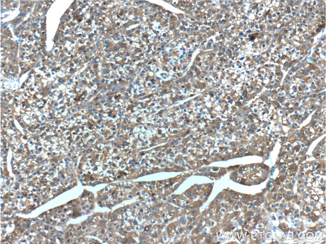 Ferritin light chain Antibody in Immunohistochemistry (Paraffin) (IHC (P))