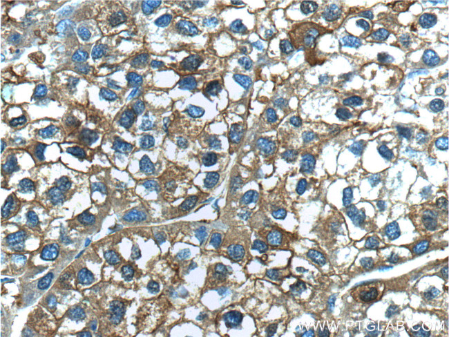 Ferritin light chain Antibody in Immunohistochemistry (Paraffin) (IHC (P))