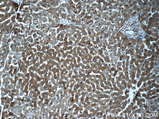 Ferritin light chain Antibody in Immunohistochemistry (Paraffin) (IHC (P))