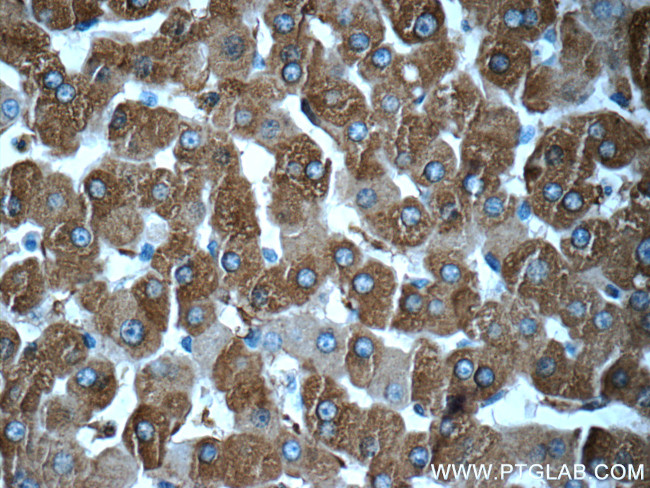 Ferritin light chain Antibody in Immunohistochemistry (Paraffin) (IHC (P))