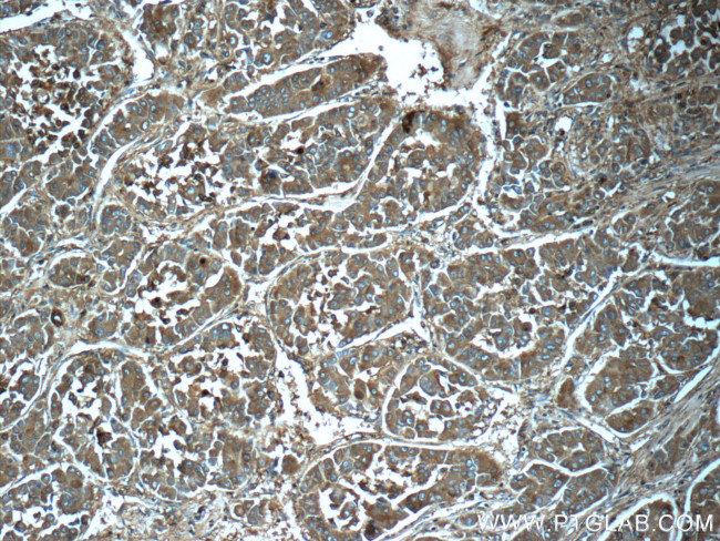 Ferritin light chain Antibody in Immunohistochemistry (Paraffin) (IHC (P))