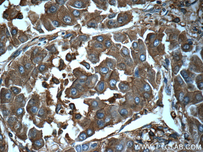 Ferritin light chain Antibody in Immunohistochemistry (Paraffin) (IHC (P))