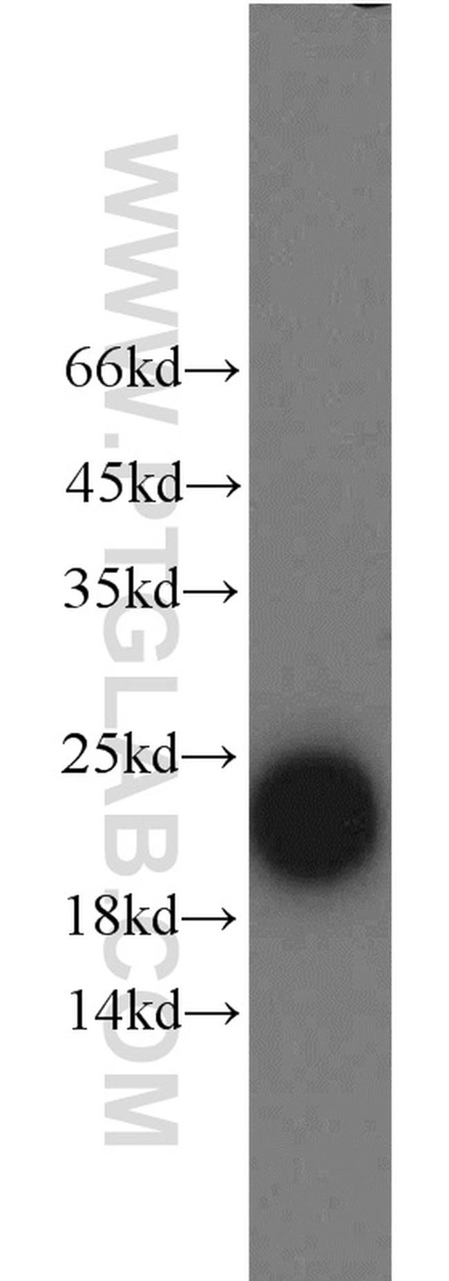 Ferritin light chain Antibody in Western Blot (WB)