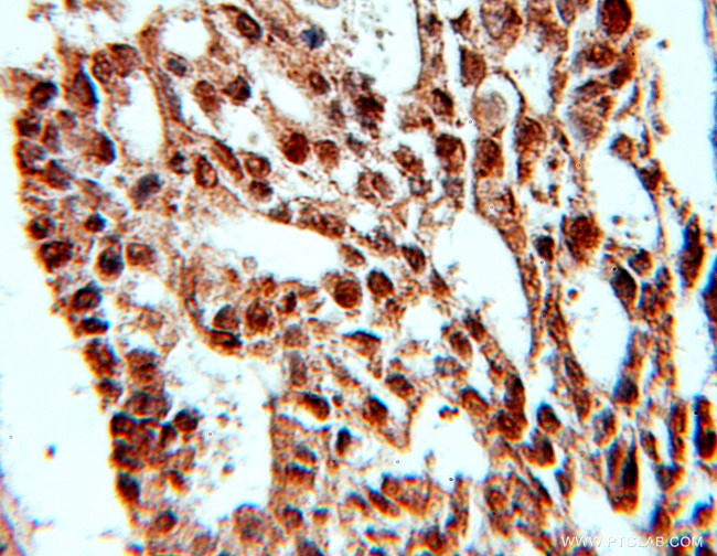 PRPF4 Antibody in Immunohistochemistry (Paraffin) (IHC (P))