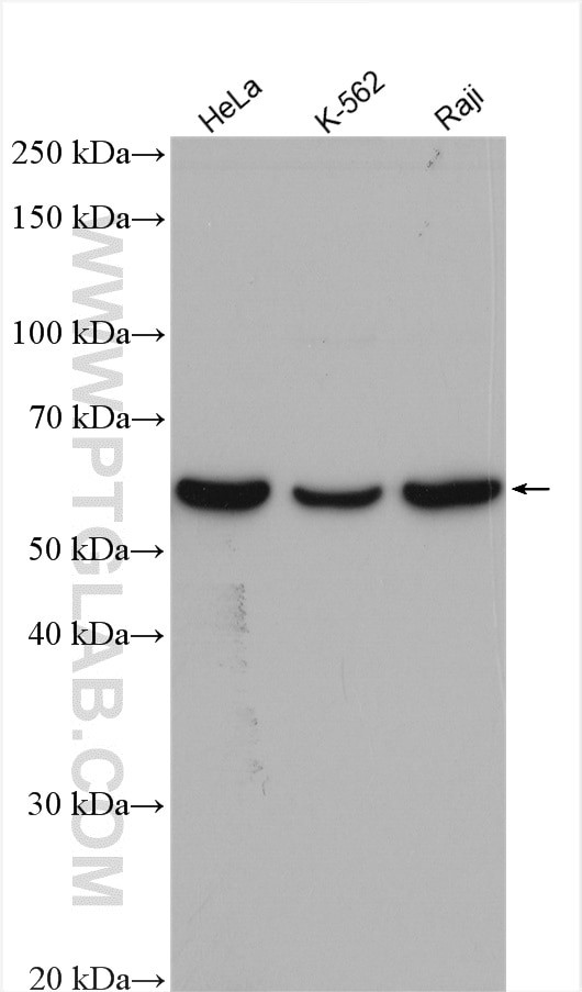 PRPF4 Antibody in Western Blot (WB)