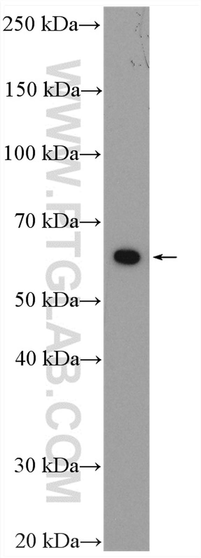 PRPF4 Antibody in Western Blot (WB)