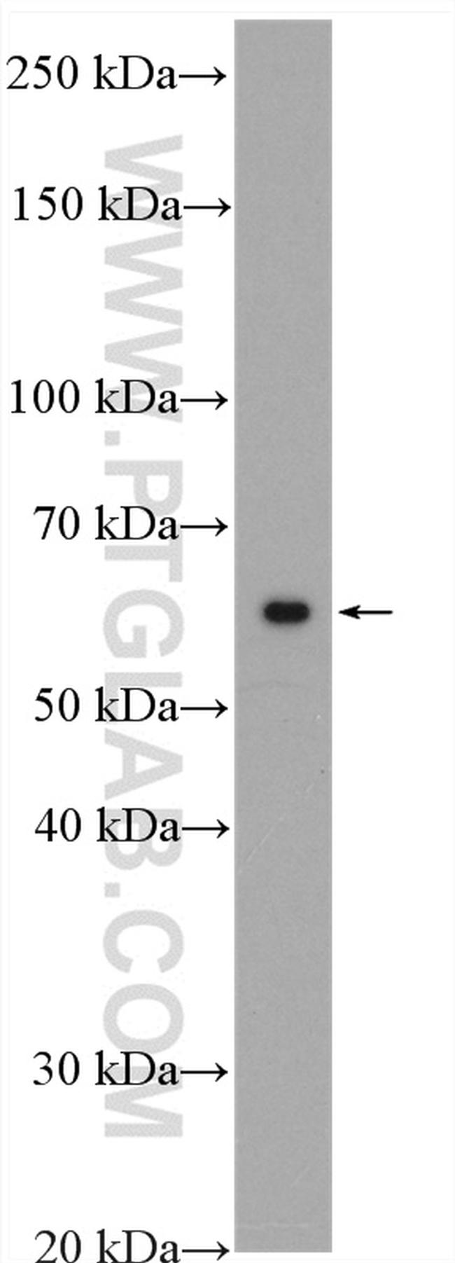 PRPF4 Antibody in Western Blot (WB)