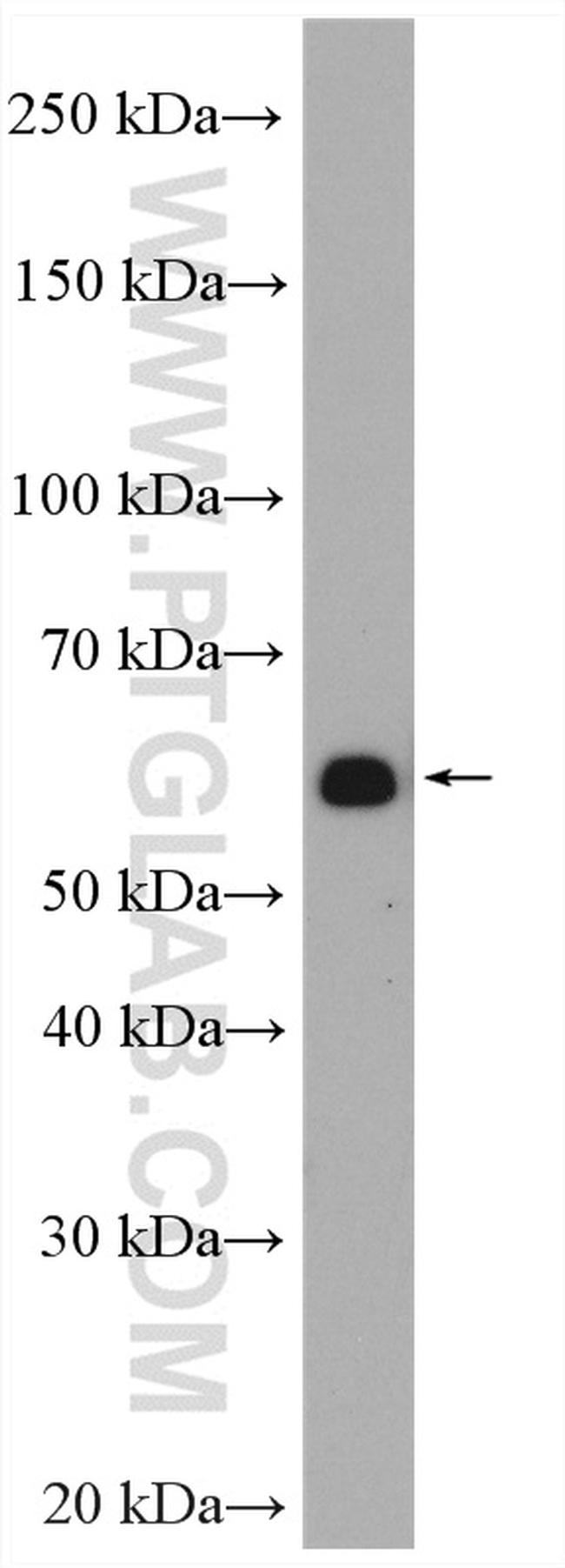 PRPF4 Antibody in Western Blot (WB)