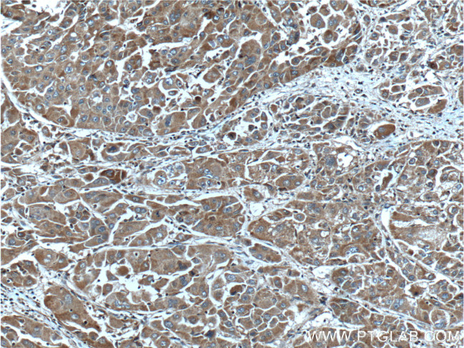 AKR7A2 Antibody in Immunohistochemistry (Paraffin) (IHC (P))