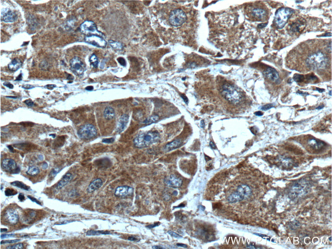 AKR7A2 Antibody in Immunohistochemistry (Paraffin) (IHC (P))