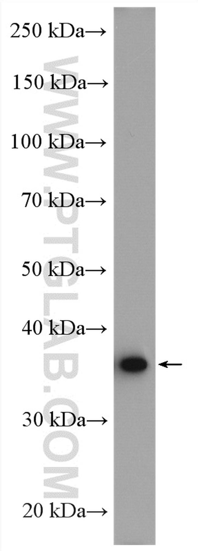 AKR7A2 Antibody in Western Blot (WB)