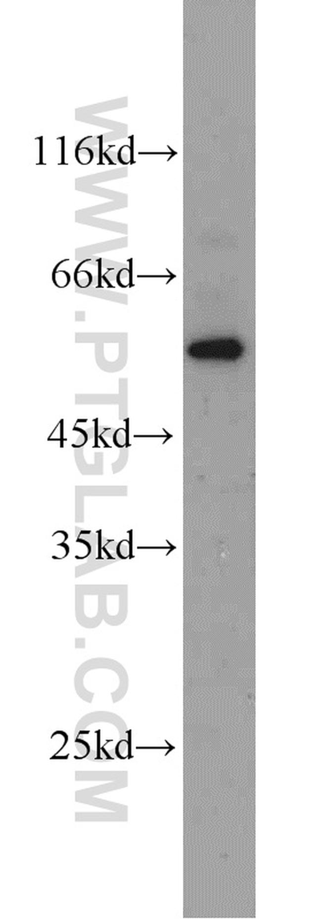 MYOT Antibody in Western Blot (WB)