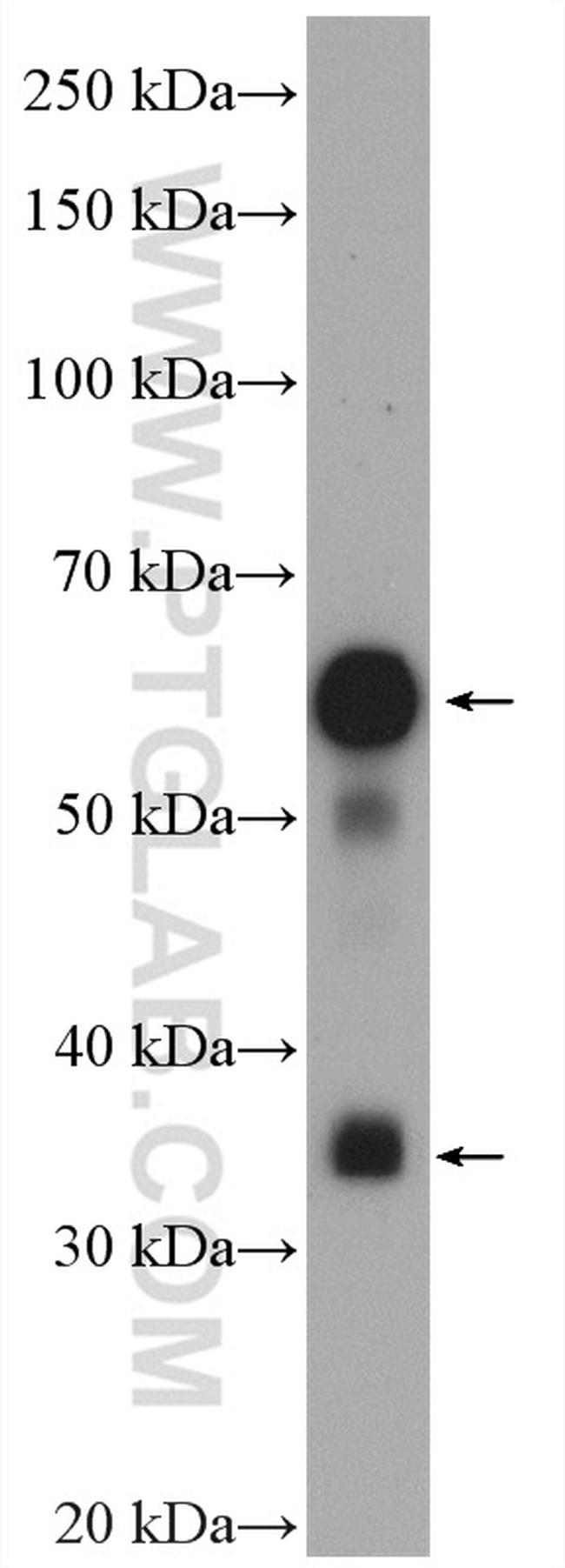 MYOT Antibody in Western Blot (WB)