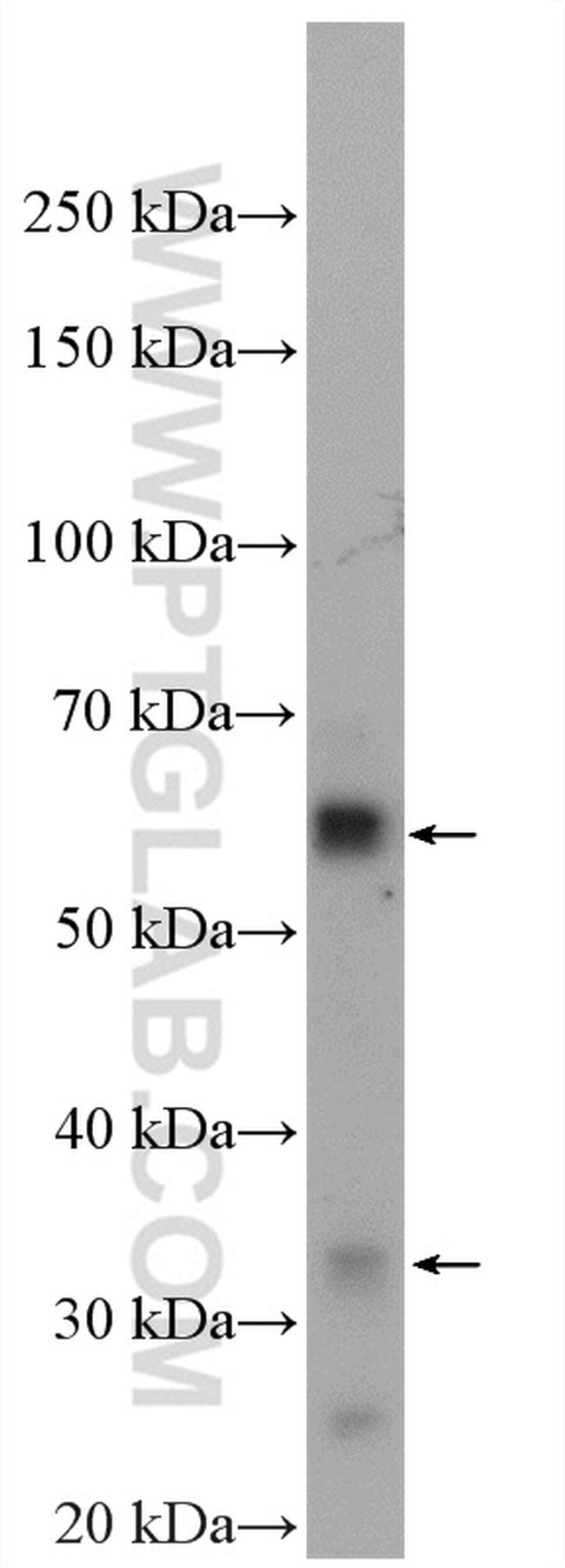 MYOT Antibody in Western Blot (WB)