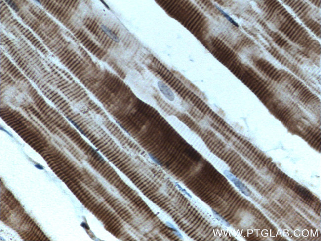 MYOT Antibody in Immunohistochemistry (Paraffin) (IHC (P))