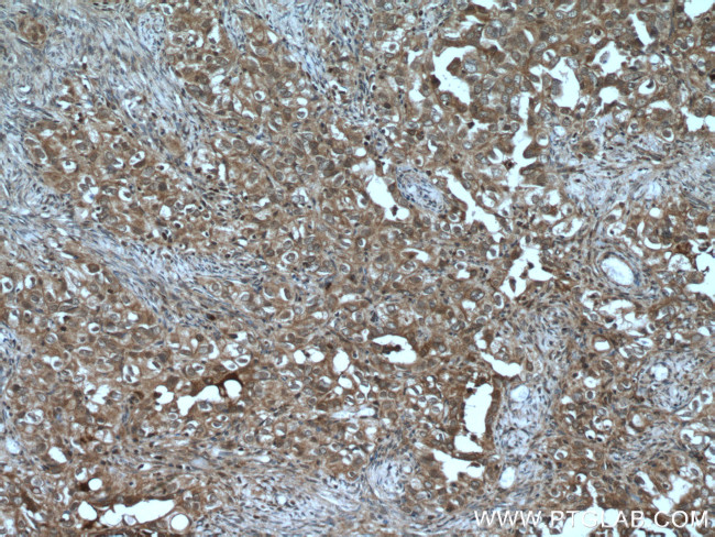 UBE2B Antibody in Immunohistochemistry (Paraffin) (IHC (P))