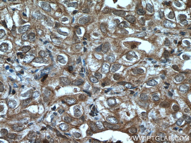 UBE2B Antibody in Immunohistochemistry (Paraffin) (IHC (P))