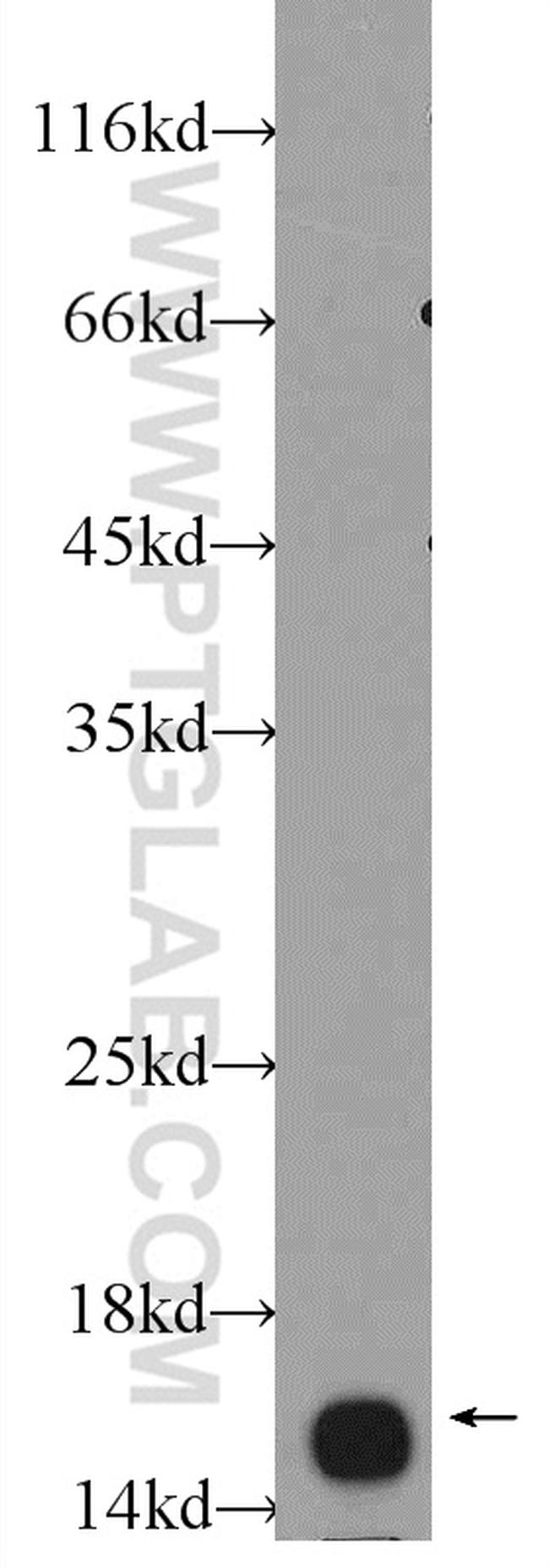 UBE2B Antibody in Western Blot (WB)