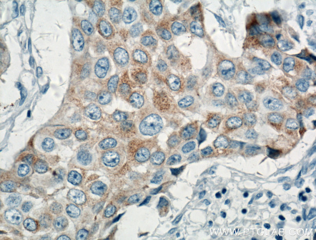 MGP Antibody in Immunohistochemistry (Paraffin) (IHC (P))